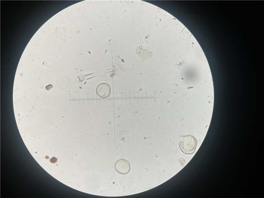 显微镜下的水稻型花粉。